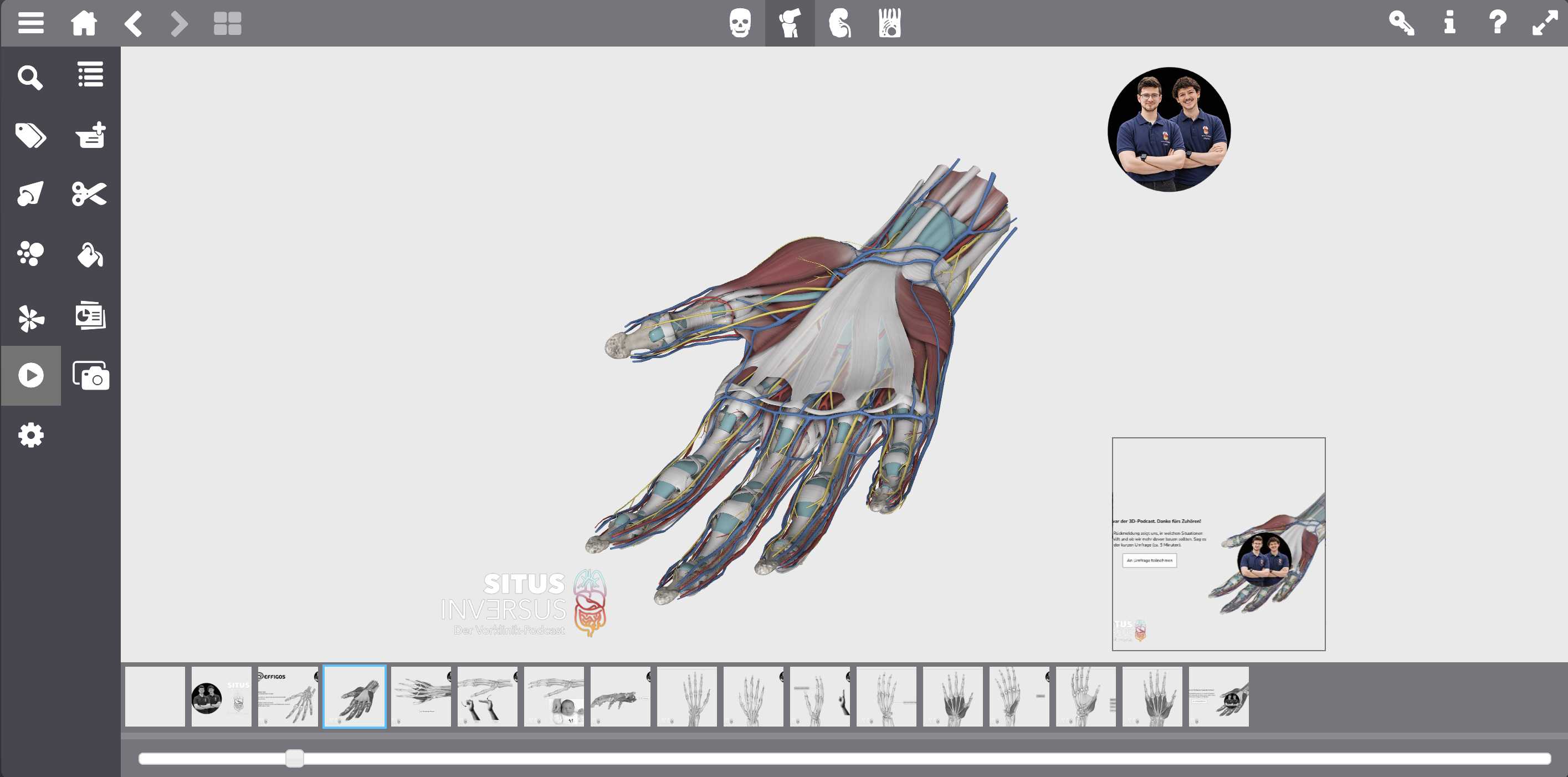 Den 3D-Podcast im Effigos Anatomy Explorer entdecken